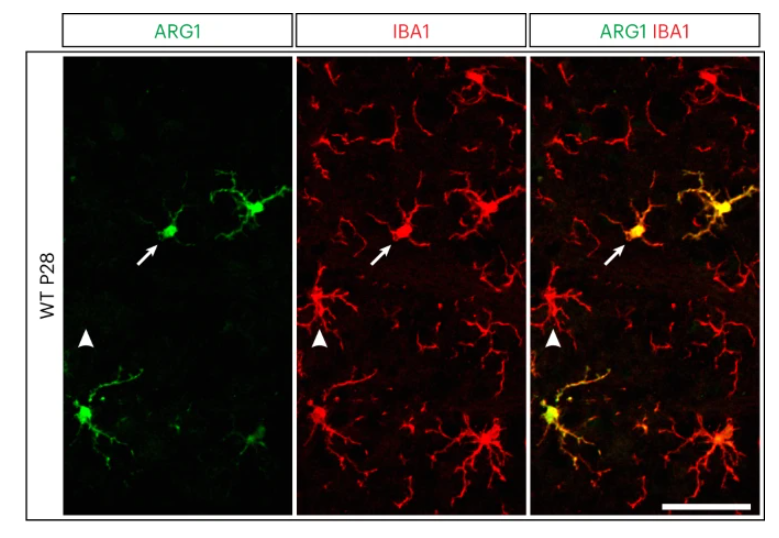 Microglia and their role in brain health